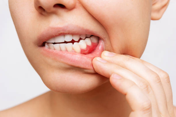 10 Ways To Manage Tooth Sensitivity Effectively